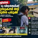 ഇരുമ്പുകമ്പി തലയിൽ പതിച്ച് പ്ലസ് ടു വിദ്യാർത്ഥിക്ക് ഗുരുതര പരുക്ക്